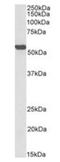 Aldehyde Dehydrogenase 2 Family Member antibody, orb389354, Biorbyt, Western Blot image 