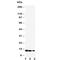 Interleukin 13 antibody, R30788, NSJ Bioreagents, Western Blot image 