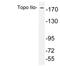 DNA Topoisomerase II Alpha antibody, LS-C200027, Lifespan Biosciences, Western Blot image 