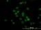 Histone Deacetylase 1 antibody, H00003065-M14, Novus Biologicals, Immunofluorescence image 