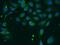 Transforming Acidic Coiled-Coil Containing Protein 2 antibody, 11407-1-AP, Proteintech Group, Immunofluorescence image 