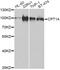 Carnitine Palmitoyltransferase 1A antibody, MBS129795, MyBioSource, Western Blot image 