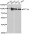 Carnitine Palmitoyltransferase 1A antibody, MBS129795, MyBioSource, Western Blot image 