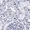 AKAP4 antibody, PA5-52230, Invitrogen Antibodies, Immunohistochemistry paraffin image 