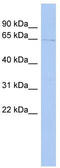 Tigger Transposable Element Derived 1 antibody, TA340412, Origene, Western Blot image 