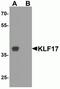Kruppel Like Factor 17 antibody, NBP2-82001, Novus Biologicals, Western Blot image 