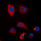 Proteasome 26S Subunit, Non-ATPase 2 antibody, LS-C352735, Lifespan Biosciences, Immunofluorescence image 