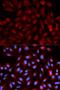 Proteasome Activator Subunit 3 antibody, orb129726, Biorbyt, Immunofluorescence image 