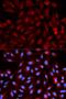 Proteasome Activator Subunit 3 antibody, orb129726, Biorbyt, Immunofluorescence image 