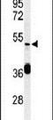 DEAD-Box Helicase 49 antibody, PA5-26962, Invitrogen Antibodies, Western Blot image 