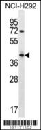 Arrestin Domain Containing 5 antibody, 56-431, ProSci, Western Blot image 