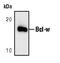 BCL2L2-PABPN1 Readthrough antibody, MA5-15076, Invitrogen Antibodies, Western Blot image 