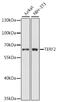 Telomeric Repeat Binding Factor 2 antibody, 13-048, ProSci, Western Blot image 