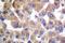 TGF beta antibody, GTX66628, GeneTex, Immunohistochemistry paraffin image 