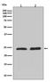 Ras Homolog Family Member A antibody, M00207-1, Boster Biological Technology, Western Blot image 