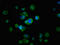 Ras-related protein Rab-3A antibody, LS-C671073, Lifespan Biosciences, Immunofluorescence image 