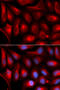 Proteasome Subunit Alpha 5 antibody, 19-834, ProSci, Immunofluorescence image 