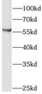 Limb Development Membrane Protein 1 Like antibody, FNab04804, FineTest, Western Blot image 