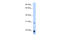 N-Acylsphingosine Amidohydrolase 1 antibody, AP43756PU-N, Origene, Western Blot image 