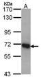 DEAD-Box Helicase 5 antibody, GTX100234, GeneTex, Western Blot image 