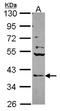 Cofilin 1 antibody, orb14562, Biorbyt, Western Blot image 