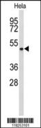 Alcohol Dehydrogenase 6 (Class V) antibody, 63-836, ProSci, Western Blot image 