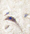 Dishevelled Associated Activator Of Morphogenesis 1 antibody, abx031655, Abbexa, Immunohistochemistry paraffin image 