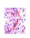 Colony Stimulating Factor 1 antibody, NBP1-59425, Novus Biologicals, Immunohistochemistry paraffin image 