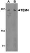 Rho Guanine Nucleotide Exchange Factor 17 antibody, A10510, Boster Biological Technology, Western Blot image 