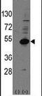 Nuclear Receptor Subfamily 0 Group B Member 1 antibody, PA5-12270, Invitrogen Antibodies, Western Blot image 