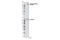 Erb-B2 Receptor Tyrosine Kinase 3 antibody, 2842S, Cell Signaling Technology, Western Blot image 
