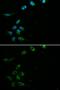 Hereditary hemochromatosis protein antibody, GTX54085, GeneTex, Immunocytochemistry image 