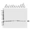 Calcineurin Like EF-Hand Protein 2 antibody, VMA00549, Bio-Rad (formerly AbD Serotec) , Western Blot image 