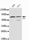 TGF-Beta Activated Kinase 1 (MAP3K7) Binding Protein 1 antibody, TA347060, Origene, Western Blot image 