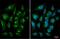 Mechanistic Target Of Rapamycin Kinase antibody, GTX630199, GeneTex, Immunocytochemistry image 