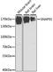 Synaptosome Associated Protein 91 antibody, A10073, Boster Biological Technology, Western Blot image 