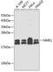 NME/NM23 Nucleoside Diphosphate Kinase 1 antibody, 13-111, ProSci, Western Blot image 