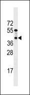 PTC7 Protein Phosphatase Homolog antibody, 59-609, ProSci, Western Blot image 