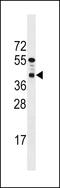 PTC7 Protein Phosphatase Homolog antibody, 59-609, ProSci, Western Blot image 