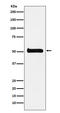 Unc-51 Like Kinase 3 antibody, M07706, Boster Biological Technology, Western Blot image 