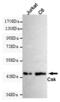 C-Terminal Src Kinase antibody, MBS475092, MyBioSource, Western Blot image 