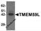 Transmembrane Protein 59 Like antibody, 6435, ProSci Inc, Western Blot image 