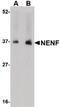 Neudesin Neurotrophic Factor antibody, PA5-20577, Invitrogen Antibodies, Western Blot image 
