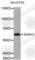 N-Acylsphingosine Amidohydrolase 1 antibody, A3745, ABclonal Technology, Western Blot image 