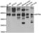 Somatostatin Receptor 4 antibody, LS-C349007, Lifespan Biosciences, Western Blot image 