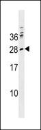 Pre T Cell Antigen Receptor Alpha antibody, PA5-49122, Invitrogen Antibodies, Western Blot image 