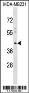 Potassium Voltage-Gated Channel Subfamily J Member 15 antibody, 58-954, ProSci, Western Blot image 