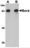 BORA Aurora Kinase A Activator antibody, 5117, ProSci, Western Blot image 