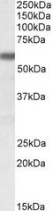 PHI antibody, PA5-19225, Invitrogen Antibodies, Western Blot image 