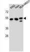Tubulin Beta 6 Class V antibody, AP54418PU-N, Origene, Western Blot image 